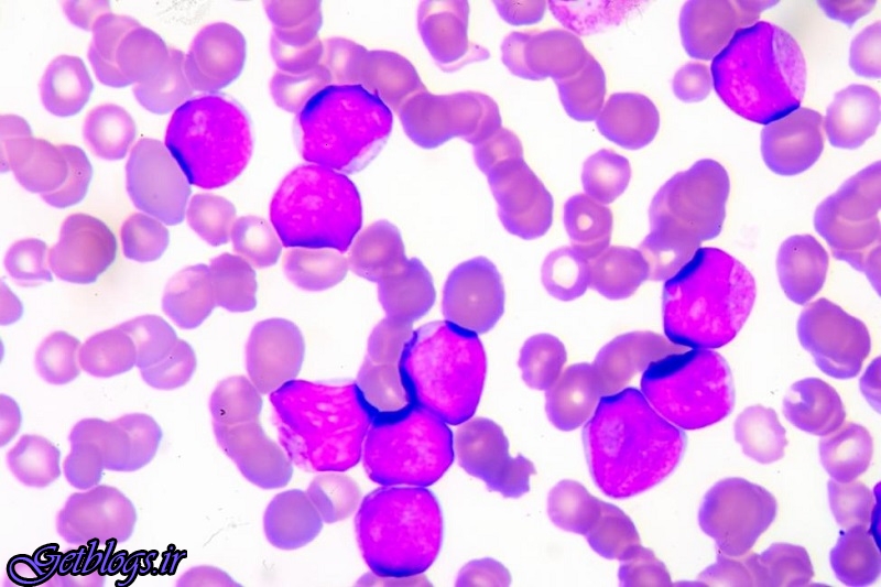 سلول های سرطانی با PH پایین ضعیف تر هستند