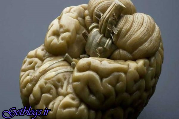 اندازه گیری هوش انسان از روی تصویرهای مغز