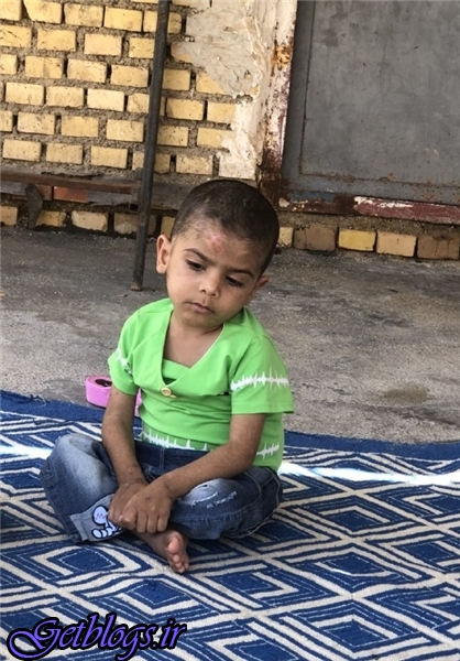 عکس) + از شکستن دندان با چکش تا بستن لب‌های دختر فرزند ۱۲ ساله با چسب حراراتی (