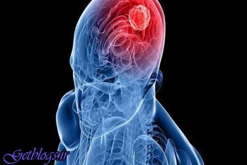 ارتباط سندروم ژنتیکی و تومور مغزی در کودکان