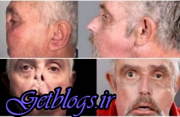 عکس های تلاش پزشکان جهت انجام عمل پیوند کامل صورت تلاش پزشکان جهت انجام عمل پیوند کامل صورت