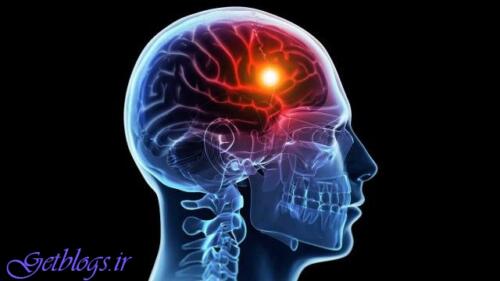 عکس های نیمی از سکتههای مغزی قابل پیشگیری هستند نیمی از سکتههای مغزی قابل پیشگیری هستند