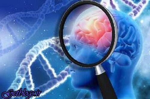 عکس های آینده نگری زودهنگام زوال عقل آینده نگری زودهنگام زوال عقل