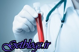 موفقیت در تزریق خون جوان در افراد مسن جهت نابودی بیماری‌ها