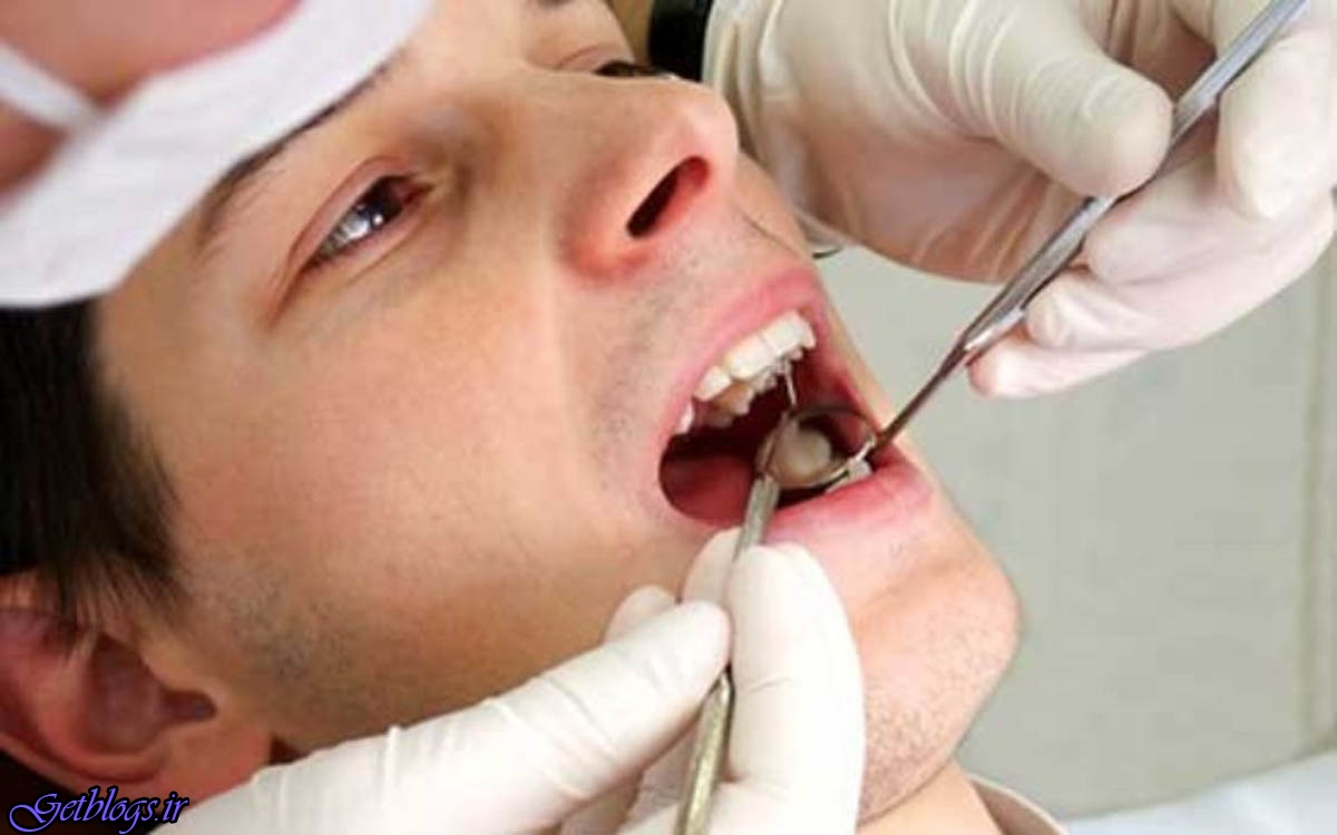 پاکسازی پلاک دهان بدون استفاده از دارو