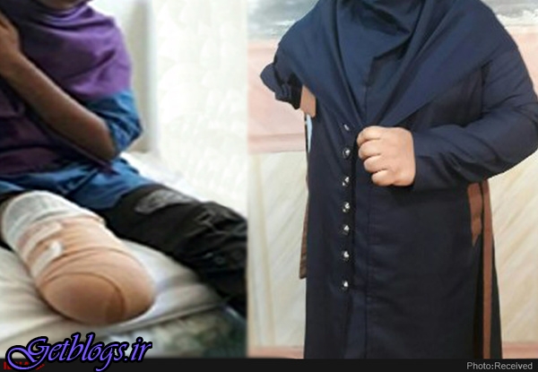 برایم نخریدند، دست مصنوعی متحرک&quot، دیگر کسی اسمی از اتفاق داراب نمی‌برد ، بعد از یکسال هنوز &quot